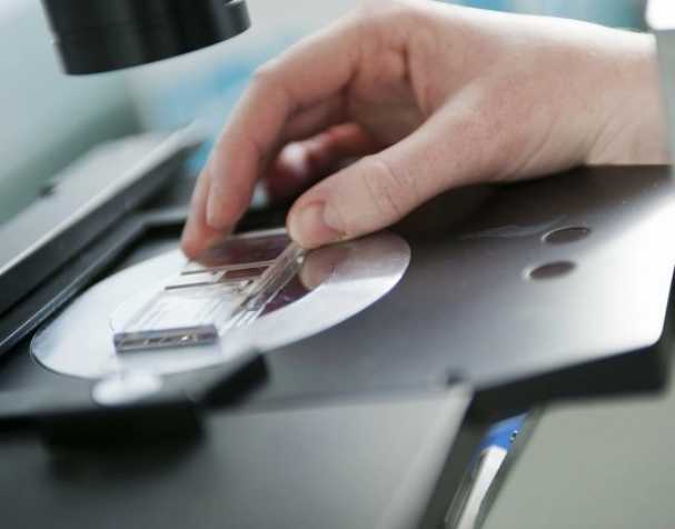 SAMe或成慢性結腸炎新希望? SAMe或成慢性結腸炎新希望?